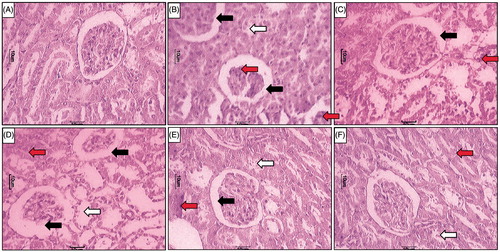 Figure 3. Effect of LG on STZ-induced alterations in kidney histology. Photomicrograph of sections of kidney of (A) normal, (B) diabetic control rats, (C) Sitagliptin (5 mg/kg, p.o.) treated rats (C), LG (250 mg/kg, p.o.) treated rats (D), LG (500 mg/kg, p.o.) treated rats (E) and LG (1000 mg/kg, p.o.) treated rats. H & E staining at 100×. Increase in thickening of the basement membrane (black arrow), necrosis (white arrow) and inflammatory infiltration (red arrow).