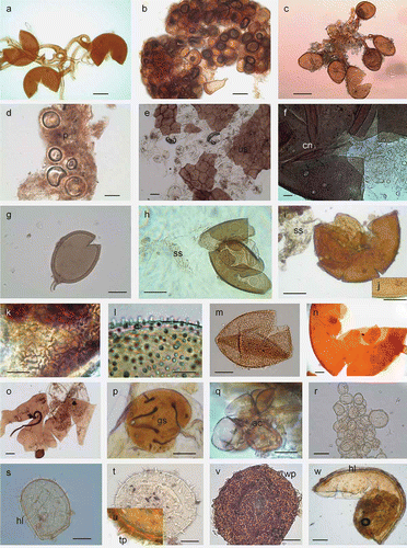 Figure 3. Arbuscular mycorrhizal fungi isolated from potato field. (a) Glomus macrocarpum. Bar = 200μm; (b) G. clavisporum. Bar = 150μm; (c) G. fuegianum. Bar = 200μm; (d) peridium [p] surrounding the spores of G. tortuosum. Bar = 200μm; (e) spores of G. aggregatum inside unidentified spore [us]. Bar = 500μm; (f) spores of G. microaggregatum inside cyst nematode [cs]. Bar = 500μm; (g) Glomus sp 1. Bar = 100μm; (h) Acaulospora tuberculata with sporiferous saccule [ss]. Bar = 50μm; (i) A. cavernata with sporiferous saccule. Bar = 50μm; (j) pitted ornamentation on the wall of A. cavernata. Bar = 10μm; (k) ridges on the surface of A. rehmii. Bar = 10μm; (l) wall of Pacispora chimonobambusae with clavate projections. Bar = 10μm; (m) P. bolivianawith ornamented pits. Bar = 100μm; (n) Gigaspora margarita. Bar = 400μm; (o) Scutellospora sp 2. Bar = 300μm; (p) germination shield [gs] of Scutellospora sp 2. Bar = 20μm; (q) auxiliary cells [ac] of Scutellospora sp 2. Bar = 10μm; (r) Pacispora like spore with ornamentation on the wall. Bar = 200μm; (s) hyaline layer [hl] on the wall of unidentified species. Bar = 100μm; (t) unidentified species. Bar = 100μm; (u) thorn like projection [tp] on the wall of unidentified species. Bar = 25μm; (v) wart like projection [wp] on the wall of unidentified species. Bar = 100μm & (w) hyaline layer on the wall of unidentified species. Bar = 200μm.