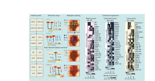 Figure 1. Contextual miRNA and protein signatures for cancer diagnostics and treatment.On the left is a flow chart of a conceptual high-density marker detection platform. Physical compartmentalization yields four contiguous but insulated compartments for the parallel detection of independent biomarkers from the tumor core to adjacent normal tissue. Specific locked nucleid acid-modified DNA probes are dispensed in each compartment (marker panel) and tissue slides are subjected to in situ hybridization assay. miRNA signal is revealed by tyramide signal amplification (TSA) reactions with green fluorochrome-tyramine substrate (color 1; detection assay). After hydrogen peroxide incubation to inactivate HRP from the preceding TSA reaction, protein expression is revealed by a new round of TSA reactions with a different fluorochrome–tyramine substrate (color 2). After heat-induced epitope retrieval, expression of additional proteins is revealed by sequential TSA reactions with other fluorochrome–tyramine substrates (colors 3 and 4). In this example, the colorized tissue cartoon provides a virtual rendition of the expected staining pattern for each marker on an ER+PR+HER2- breast cancer specimen (multiplex staining). On the right are tentative and speculative multimarker panels based on biomarkers already incorporated in routine clinical practice and promising translational biomarkers. Computer-assisted image analysis will be used to quantitate the expression levels of each marker. This information will be used to generate contextual signatures that reflect molecular changes within the cancer cells (CK19+) or other cellular compartments of the tumor microenvironment, such as reactive fibroblast (vimentin+) and immune cells (CD45+), to inform treatment selection and intensity in prevalent solid tumors.AdCa: Adenocarcinoma; EGFR: EGF receptor; ER: Estrogen receptor; H: High; HER2: Human EGF receptor 2; HRP: Horseradish peroxidase; L: Low; M: Medium; MMP: Matrix metalloproteinase; MSI: Microsatellite instable: MSS: Microsatellite stable; PR: Progesterone receptor; SCC: Squamous cell carcinoma.