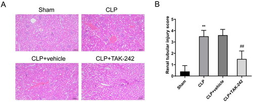 Figure 2. TAK-242 attenuates pathological damage of kidney tissues in septic rats. (A) H&E staining to observe the pathological changes in the kidney tissues of rats in Sham group, CLP group, CLP + vehicle group, and CLP + TAK-242 group; (B) kidney tissue damage scores of rats in each group based on the results of Figure 2(A). **p < 0.01, vs. Sham group; ##p < 0.01, vs. CLP + vehicle group.