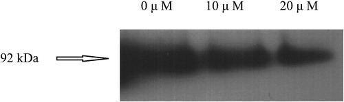 Figure 3 Effect of CMT‐3 on extracellular MMP‐9 levels in E‐10 cells (Western blot analysis). Cells were cultured in serum‐free medium in the absence or presence of CMT‐3 for 48 hours. Conditioned medium was collected and centrifuged to remove cell debris. 2 µL aliquots were analyzed by Western blotting, using an anti‐MMP‐9 mAb. The location of a 92 kDa standard is indicated by the arrow.
