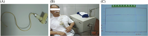 Figure 1. (A) Instrument used for hyperthermia and temperature monitor; (B) patient being treated with hyperthermia; (C) temperature curve during hyperthermia therapy.