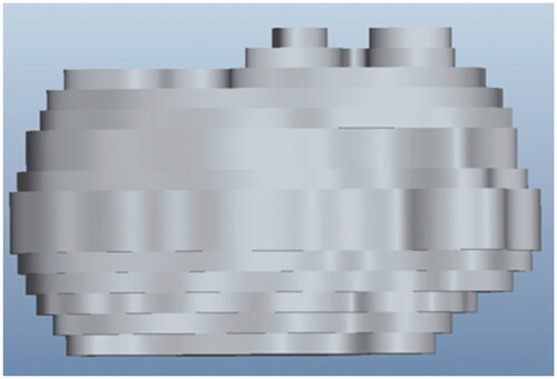 Figure 3. Approximation of a tumour geometry constructed in ProE® from 13 microCT slices.