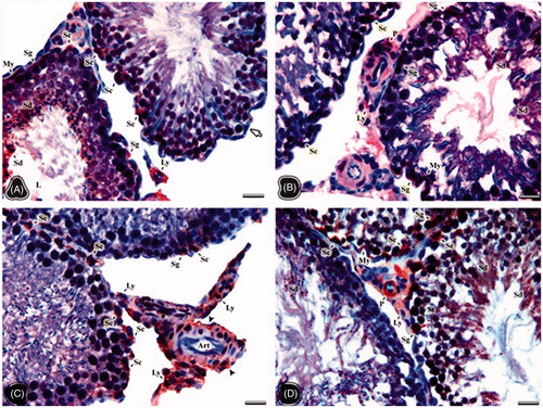 Figure 2. The light microscopical sections of testis belonging to the non-obese control (A), obese control (B), non-obese thymoquinone (C), and obese thymoquinone (D) groups are shown. Sg: spermatogonia, Sc: sertoli cell, Sd: Spermatid, St: spermatocyte, Ly: Leydig cell, My: myoid cell, P: pericytes, L: tubule lumen. (A) Arrow: negative staining of Sertoli cell. (C) Art: arteriole, Arrowhead: vessel wall. Histological structure of testis is seen in the all groups. Luteinizing hormone (LH) receptor positivity is shown by immunohistochemistry in the nuclei of the positive stained cells (signed). LH receptor activity was observed in the cells occupying the connective tissue and vascular walls rather than tubular and Leydig cells of the obese control group. But following thymoquinone application, more positive cells were seen in the light microscopical sections of the obese thymoquinone group. Dye: anti-LH/choriogonadotrophic hormone (CG) receptor immune stain; Scale Bars: 25 µm.