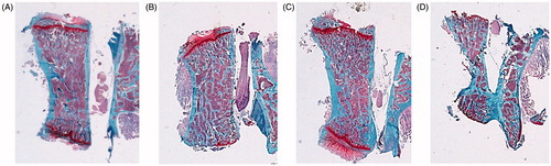 Figure 9. Safranin staining 4×. Cortical component of the L4 vertebrae. Sham-operated rats (SHAM) (A) and orchidectomized rats (ORX) (B) as baseline and castrated rats with 10 mg/kg/twice a week of OPG–Fc (ORX + OPG–Fc) (C) or testosterone cypionate (1.7 mg/kg/once a week) (ORX + testosterone) (D). Safranin staining. Magnification 4×. Safranin staining let orient the samples in a same plane, because growing palates are identified in red, staying in an upper and lower view.