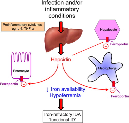 Figure 4. The principal regulator of iron status is hepcidin. Infection and inflammatory conditions increase hepatic hepcidin production via proinflammatory cytokines. Hepcidin binds to ferroportin on enterocytes, macrophages and hepatocytes resulting in its internalization and sequestration of iron in intracellular stores. This decreases iron availability for pathogens but also compromises iron availability for erythropoiesis which can cause functional anemia which is refractory to oral iron therapy.