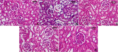 Figure 9 Histopathological alterations in the renal tissue following glycerol injection and different treatments. (A) Control, (B) AKI, (C) Na2SeO3+AKI, (D) LYC+AKI, and (E) LYC-SeNPs+AKI. Hematoxylin and eosin (H&E), scale bar= 50 μm.