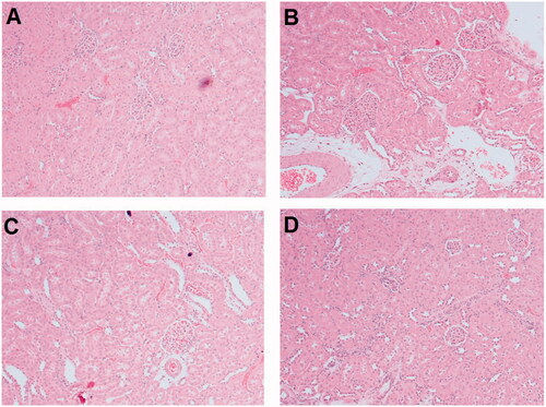Figure 5. Effect of TS suspension and formulation F4 on histopathological changes in kidney tissue of streptozotocin-induced diabetic nephropathy rats. Representative section of (A) control, (B) diabetic nephropathy, (C) treated with TS suspension, (D) treated with formulation F4. TS: telmisartan.