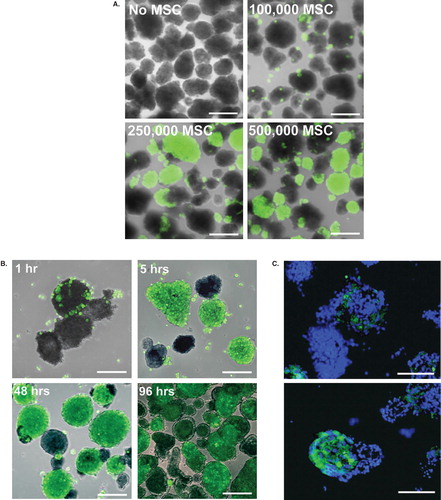 Figure 1. Coating of pancreatic islets with MSCs. Human islets were coated with CellTracked MSCs (green). A: Dose-dependent coating of islets with 100,000, 250,000, or 500,000 MSCs after 48 hours of culture. B: The initial adherence and the following spreading of MSCs after 1, 5, 48, and 96 hours of culture. One representative experiment is shown. C: MSCs within the islet core after 48 hours of co-culture, nuclei in blue. Scale bars = 100 μm.