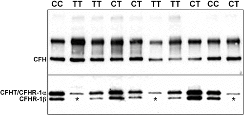 Figure 2 A representative Western blot of serum proteins from 10 of 144 individuals analyzed by nonreducing SDS‐PAGE and chemiluminescent immunoblotting. Upper panel: CFH is visualized as the faster migrating of the two immunoreactive bands (∼150 kDa; identified as CFH by co‐migration with purified CFH; not shown) in the high molecular weight region of the gel/blot. The nature of the higher molecular weight CFH antibody‐reactive band was not determined. The blot depicted was exposed to film for 3 seconds. Lower panel: CFHR1β, a glycosylated isoform of CFHR1, can be distinguished from CFHR1α and CFHT/FHL‐1 which comigrate following separation of proteins in the lower molecular weight region of the gel/blot. No immunoreactive CFHR1β is present in the serum of three patients (lanes 2, 6 and 10), two unaffected patients possessing 1277TT genotypes (protective CFH H4 haplotype) and one patient with a 1277CT genotype, respectively. Subsequent SSCP analysis and direct DNA sequencing showed that all three individuals have both a homozygous deletion of the CFHR1 and CFHR3 genes. The blot was exposed to film for 7 minutes.