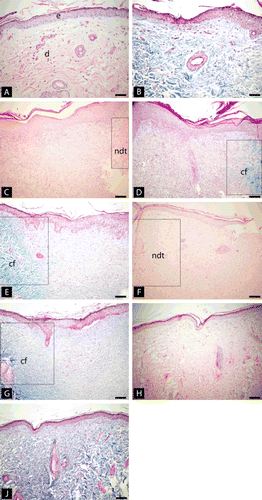 Figure 1.  Histological sections of cutaneous wound site obtained from the controls, HOT and HOTBp lesions of the rats (A) normal histological skin tissue in the first day. (H&E, ×200) (B) normal histological skin tissue in the first day samples stained with Gomori trichrome stain (×200); (C) Late phase granulation tissues which were characterized with fibroblastic proliferation and scattered lymphocytes in a fifth day subject. Normal dermal tissue is seen at right corner [(rectangular) (Hematoxylin and eosin, ×100); (D) The collagen fibers started to emerge slightly in the granulation tissue in the 5th day samples (Gomori trichrome stain, ×100); (E) a lesion at a 10th day subject. Collagen fibrils is seen as more abundant than the 10th day sample (Gomori trichrome stain, ×100), (F) a sample of control lesion in the 30th day. Healing with fibrous scar formations is seen (Hematoxylin and eosin, ×100) (G) same tissue of F with Gomori trichrome stain (×100) (H, J) Near normal skin tissue without fibros scar tissue seen in a 30th day sample treated with Bellis perennis (Hematoxylin and eosin, Gomori trichrome stain, respectively, ×100). (e) epidermis, (d) dermis, (ndt) normal dermal tissue, (cf) collagen fibers.
