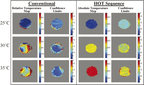 Figure 3. Demonstration of HOT sequence in cream phantom at three temperatures Citation[32]. The conventional maps were taken by monitoring the changes in phase of the water signal in a phantom of cream (homogeneous mixture of water and fat) as the sample was heated. Large distortions in the detected temperature were observed (due both to shimming imperfections and to susceptibility gradients created during heating), complicating the temperature detection. The images collected using the HOT sequence show only one temperature across the images, demonstrating the clean temperature detection of the HOT sequence. Next to both sets of images are the 90% confidence intervals showing the quality of the fit of each voxel. TE (echo time) = 60 ms, TR (repetition time) = 5 s, τ = 2.67 ms, t1 = 3 to 11 ms, indirect spectral width = 5000 Hz, correlation distance = 140 µm, voxel size = 0.0625 cm3.