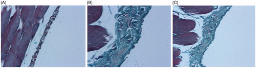 Figure 3. Effects of PNS on the peritoneum tissue of rats examined by Masson's trichrome staining. (A) Saline group, (B) Standard PDF group, and (C) PNS group. Original magnification 200x.