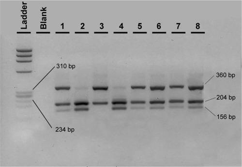 Figure 2 Agarose electrophoresis result of the CD14 C260T PCR-RFLP genotyping method.