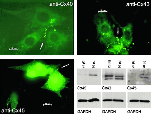 Figure 1 Immunocytochemical staining of neonatal rat cardiomyocytes (anti-Cx40, anti-Cx43, and anti-Cx45 stained) and Western Blot analysis (detection of Cx40, Cx43, Cx45, and GAPDH). All three connexins are expressed and assemble in the cell membrane (see arrows). Scale bar = 10 μ m.