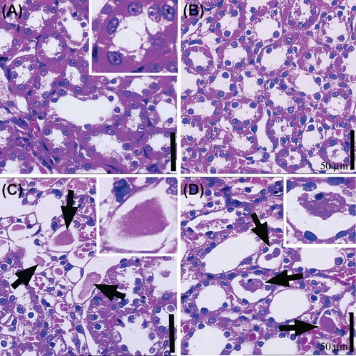Figure 3.  The medullary area of kidney tissue in (A) the intact control group, (B) intact amlodipine group, (C) urolithiasis group, and (D) amlodipine plus urolithiasis group.Note: Crystal deposits (white arrow and square area) are observed in the intratubular area and degenerative tubular structures in the medullary area of the (C) urolithiasis model group and (D) amlodipine plus urolithiasis group.Scale bar: 50 μm.