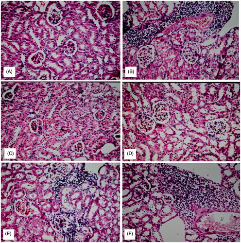 Figure 5. Nephroprotective effect of BHPF in CCl4-intoxicated mice. (A) Group I (normal control): showing normal histological structure of the glomeruli and tubules at the cortex with absence of histopathological alterations. (B) Group II (CCl4-treated group): showing marked inflammatory cell aggregation in between the tubules, marked degeneration in the lining epithelium of all the tubules, and blood vessel congestion. (C) Group VI (CCl4 + 200 mg/kg of silymarin): showing absence of histopathological alterations. (D) Group V (CCl4 + 400 mg/kg of BHPF): showing normal histological structure. (E and F) Groups IV and III (CCl4 + 200 mg/kg and CCl4 + 100 mg/kg of BHPF, respectively): showing mild inflammatory cell infiltration in between the tubules (H&E, × 20).