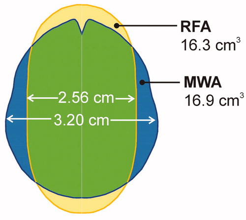 Figure 5. Overlapping coagulation zones after 10 min of RFA (∼51 W) and MWA (60 W). Note that while the volumes offer similar values, the MWA transverse diameter is larger.