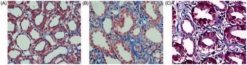 Figure 5. Tubular and interstitial lesions in kidney using Masson’s trichrome stain. Note: ×400 (A) WKY 24W, (B) SHR 12W, (C) SHR 24W.