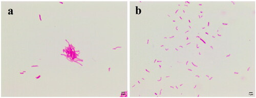 Figure 2. Morphological changes of Mtb. (a) Negative control group; (b) treatment with 1 μg/mL compound 4.