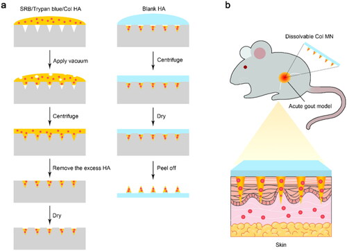 Figure 1. Fabrication and application of Col-loaded MNs. (a) Dissolvable MNs were prepared by a mold casting method using HA (w/o certain substances) addition, vacuum centrifugation, and a drying procedure. (b) Col-loaded MN array was locally applied to the skin of rats with acute gout to achieve transdermal Col delivery with minimal invasion. Abbreviations: SRB: sulforhodamine B; Col, colchicine; MN, microneedle; HA, sodium hyaluronate.