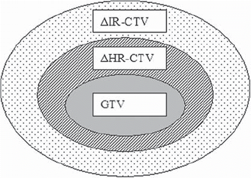 Figure 2. Definition of the calculated volumes ΔHR-CTV and ΔIR-CTV based on the GEC-ESTRO volumes HR-CTV and IR-CTV.