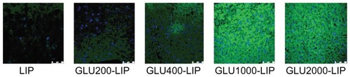 Figure 6 Confocal laser scanning microscopy images of the mouse brain frozen sections 1 hour after the intravenous injection of different coumarin 6-loaded liposomes.Note: The scale bar is 75 μm on the lower right corner in each image.Abbreviations: GLU, glucose; LIP, liposomes.