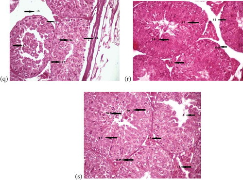 Figure 1. (Continued). (q) Testes of mice treated with AlCl3, vitamin E and propolis for one week at (400x). Interstitial spaces (I S), spermatocytes (Sp), seminiferous tubules (S T), tunica albuginea (T A). (r) Cross section of testes of male albino mice showing effects after treatment with AlCl3, vitamin E and propolis for two weeks at (400x), (H & E). Spermatocytes (Sp), interstitial spaces (I S), leydig cells (L C), basement membranes (B M), seminiferous tubules (S T). (s) Testes of mice with AlCl3, vitamin E and treated with propolis for three weeks (400x). Spermatid population (Sp P), spermatocytes (Sp), interstitial cells (I C), interstitial spaces (I S), basement membranes (B M), lumen (L), seminiferous tubules (S T)
