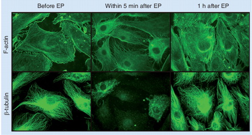 Figure 3. The effect of EP on human umbilical vein endothelial cells.The endothelial cell monolayer was exposed to three electric pulses (duration 100 µs, repetition frequency 1 Hz, amplitude 40 V, interelectrode distance 4 mm) in situ. Microtubules and actin filaments were stained with an anti-β-tubulin antibody and phalloidin respectively and analyzed by fluorescence microscopy. Before EP, cells displayed intact actin filament and microtubule networks. After application of EP, staining of actin fibers with phalloidin appeared diffused demonstrating dissociation of actin fibers, while microtubules became fragmented. Microtubule and microfilament networks recovered their structural composition within 1 h after exposure to electric pulses at amplitude of 40 V.EP: Electroporation.Reproduced with permission from Citation[86].