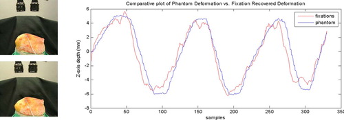 Figure 9. The recovered deformation from ocular vergence for the phantom model, where the actual deformation of the phantom heart surface as measured by an Aurora catheter-tip electromagnetic tracker is compared to the gaze-contingent reconstructed deformation. [Color version available online.]