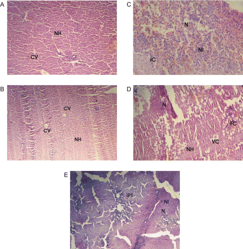 Figure 4.  (A) Section of the liver tissue of control rats showing normal hepatocytes and central vein. (C) Section of the liver tissue of rats treated with CCl4 showing severe necrosis, neutrophil infiltrate and inflammatory changes. (D) Section of the liver tissue of FRPE-pretreated rats showing normal hepatocytes necrosis and fatty changes. (B) Section of the liver tissue of FRME-pretreated rats showing normal hepatocytes and central vein. (E) Section of the liver tissue of Liv52-pretreated rats showing inflammatory changes and necrosis. NH, normal hepatocytes; CV, central vein; N, necrosis; NI, neutrophil infiltrate; IC, inflammatory cells; FC, fatty changes; VC, vacuolated cells; IPT, inflammatory infiltrate around the portal triad.