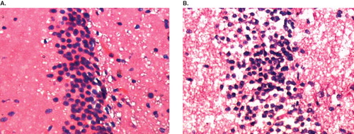 Figure 3.  Representative photomicrograph of sections of hippocampal CA3 region of the brain from both control and radio-frequency electromagnetic radiation (RF-EMR)-exposed rat stained with hematoxylin and eosin. A: Control animal; row of normal nerve cells in a section of the pyramidal cell band of the hippocampus CA3 region is seen. B: Mobile phone RF-EMR-exposed rat; among the normal nerve cells, dark (deeply stained) and shrunken nerve cells are seen.
