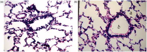 Figure 3. Histological examination of rat lung tissue after 24 h of intra-tracheal administration of (a) PBS as negative control in group I, (b) Formula L7 in group II.