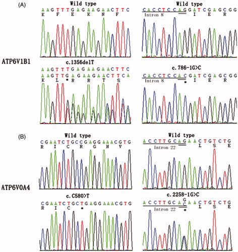 Figure 1. Novel mutations identified in ATP6V1B1 and ATP6V0A4 of patients with distal renal tubular acidosis. The mutant nucleotides are marked with asterisks.