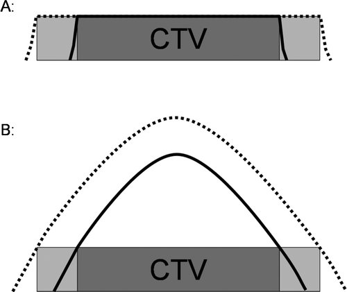 Figure 4.  Effect of margins on dose distribution in external beam radiotherapy and intracavitary cervix cancer brachytherapy: A: In external beam radiotherapy a margin for PTV (light grey) will result in an increase of the field size. The plateau of the dose distribution covering the whole PTV (dashed line) remains unchanged. B: For intracavitary brachytherapy any margin into the lateral and anterior-posterior direction will result in a change of the dose distribution within the CTV with a volume and dose increase in the high dose regions of the CTV (from solid line to dashed line dose profile).