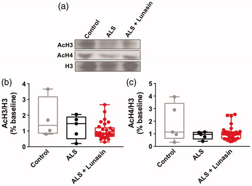 Figure 5 AcH3 and AcH4 levels in PBMCs. Representative immunoblot images of AcH3, AcH4, and H3 levels in healthy controls, ALS controls and ALS + Lunasin (a). There was no significant difference in AcH3 levels in PBMCs between groups (b). There was no significant difference in AcH4 in PBMCs between groups (c).