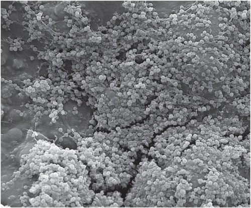 Scanning electron micrograph of biofilms on PMMA cement.