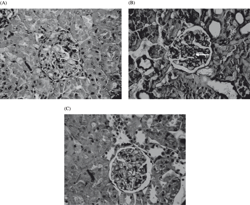 Figure 7. Light microscopes of the glomeruli. Paraffin-impeded sections of the renal cortex were stained with hematoxylin. Representative light microscope (magnification ×200) from each of the rat groups are shown: (A) Normal glomerulus from non-diabetic rat at eight weeks; (B) glomerulus from untreated STZ diabetic rats at eight weeks showing hypertrophy; irregular, denued glomerular basement membrane, mesangial expansion; and global glomerulosclerosis; with the symptoms of early diabetic nephropathy symptoms; (C) glomerulus from rats treated with eight weeks of PPE, depicting partial reversal of glomerulosclerosis.