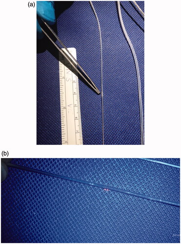 Figure 5. Evidence of slight deformation of VNS wire following direct contact with the PlasmaBlade at CUT6 COAG 5.
