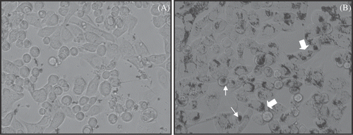 Figure 4. Microscopic study of binding and internalisation of iron oxide crystal containing nanoparticles with or without Herceptin antibody delivery to SK-BR-3 cells. Live SK-BR-3 cells were incubated for 2 h with either non-antibody-directed nanoparticles or the same amount of nanoparticles with Herceptin conjugated to the surface. After washing with PBS and without any fixation or staining, the highly malignant human breast cancer cells could be observed capping (small arrows) and internalising (large arrows) nanomaterial if directed by Herceptin (B), but retained no observable nanomaterial without the benefit of the HER-2 specific antibody (A).