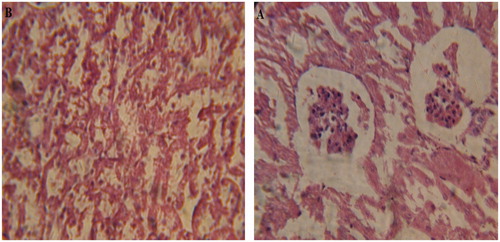 Figure 3. Photomicrographs of control group: (A) renal cortex presenting no common abnormality like glomerular atrophy or necrosis and (B) renal medulla shows normal proximal and distal tubules with no significant abnormality.