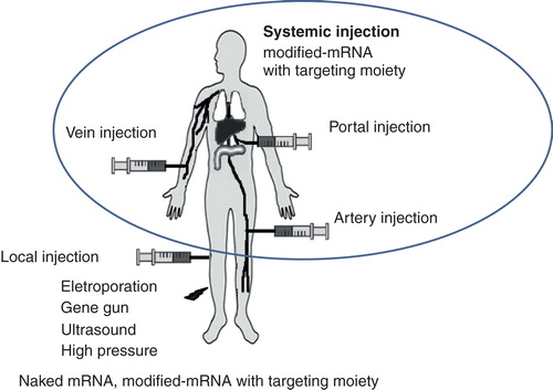 Figure 3. Different injection routes of gene delivery are outlined.