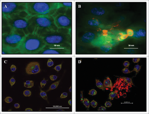 Figure 1. Double Immunofluorescence for epithelial cell line A549 and alveolar macrophages murine AMJ2-C11. (A) Uninfected A549 cells. (B) A549 cells infected with P. brasiliensis. A549 cells were labeled with FITC-phalloidin (green), P. brasiliensis stained with anti-cell free antibody and Alexa Fluor® 594 conjugate and nucleus was labeled with DAPI (blue). (C) Uninfected macrophages. (D) Macrophages infected with P. brasiliensis. Macrophages were immunolabeled with the primary antibodies anti- cytoplasmic protein and secondary conjugated Alexa Fluor R 488 (green), and P. brasiliensis immunolabeled with anti-cell-free antibody (red) and secondary conjugated Alexa Fluor ® 594, and nucleus was labeled with DAPI (blue) (Zeiss LSM 510 Meta Confocal Microscope).