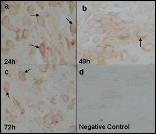 Figure 3 Staining of Dengue capsid protein in suckling mice brain at 24 (a), 48 (b) and 72 h (c) pi Uninfected suckling mouse brain as negative control (d).