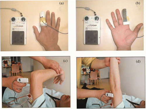 Figure 1. (a, b) Characteristics of the FEE, which is made of metal-coated fabric. (c, d) A treatment session (for elbow extension) using the FEE. One self-adhesive electrode was placed on the proximal side of the triceps brachii muscle. The therapist, outfitted with the FEE on a finger, said ‘Raise your hand as far as you can’ and started to assist the patient's motion (if any residual extension was possible). Then, the FEE was applied to the skin over the nerve which innervated the muscle to promote contraction. The muscle contraction was repeated 50-times.