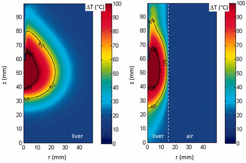 Figure 7. Bi-dimensional distribution of the temperature increase obtained radiating 60 W for 10 min in unrestricted (A) and double-thin samples (B). The white dotted line in (B) shows the boundary between liver and air.