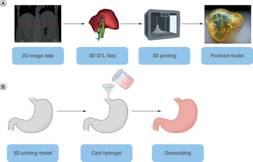 Figure 4. Typical processes for direct 3D printing and indirect 3D printing of organ models. (A) The general process of making an organ model. (B) General steps for indirect printing.STL: Stereolithography.