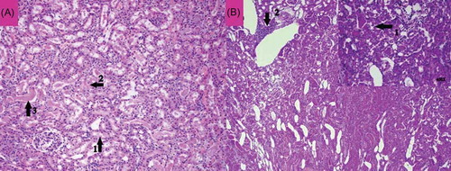 Figure 7. The histopathological examination of the renal tissue of renal ischemia-reperfusion (RIR) group. Remarkable tubular epithelial swelling (A, Arrow-1), tubular epithelial necrosis (A, Arrow-2), hyaline cast accumulation in dilated tubules (A, Arrow-3), and loss of microvillus (B, Arrow-1) were observed.