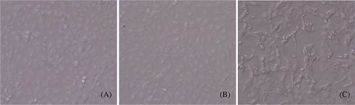 Figure 3. Morphological assessment of HK-2 cells. (A) 10% FBS group (100×); (B) 10% sham serum group (100×); (C) 10% 5/6 nephrectomized rat serum group (100×).