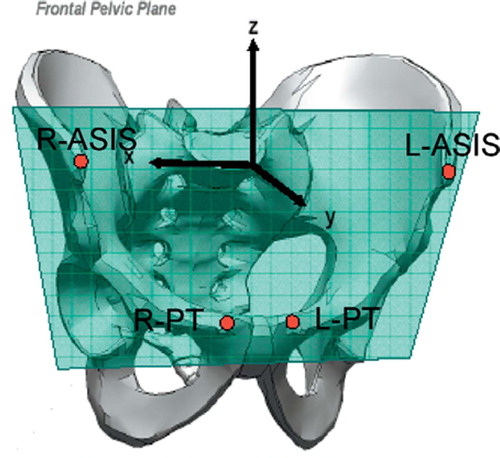 Figure 1. The frontal pelvic plane and the pelvic coordinate system as deined by four anatomical landmarks on the pelvis, the anterior superior iliac spines (ASIS) and the pubic tubercles (PT).